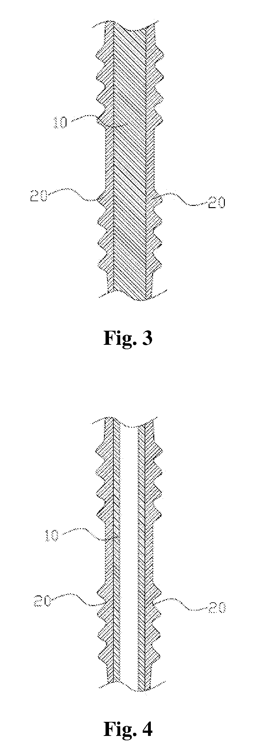 Composite metal article