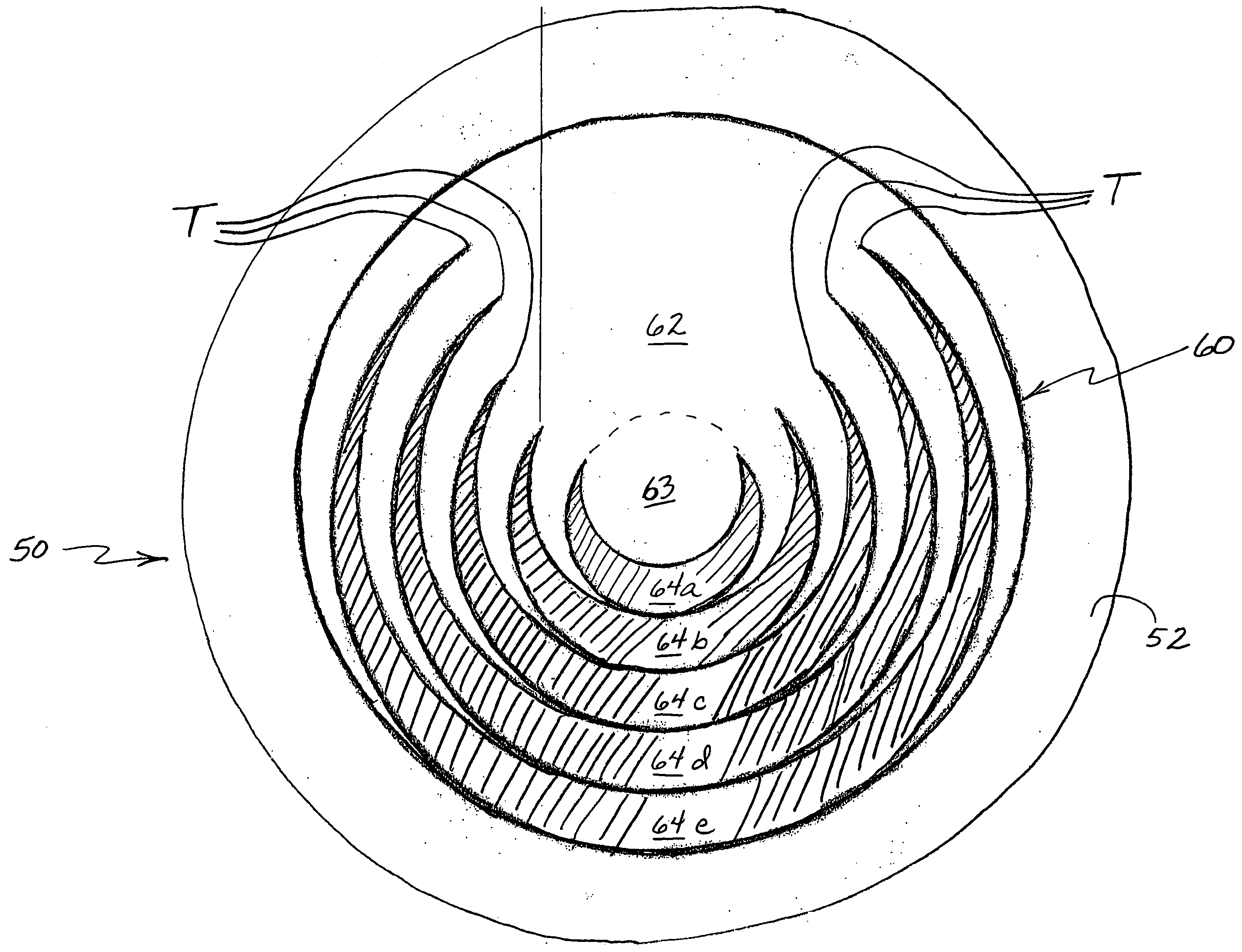 Multifocal contact lens and method of manufacture thereof