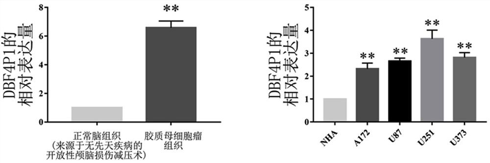 A targeted inhibitor of dbf4p1 gene and its use