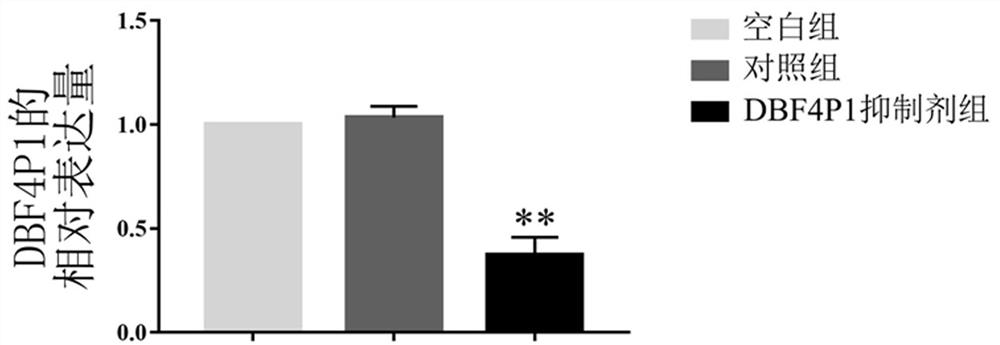 A targeted inhibitor of dbf4p1 gene and its use