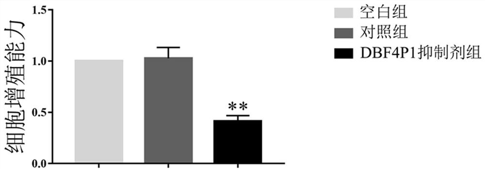 A targeted inhibitor of dbf4p1 gene and its use