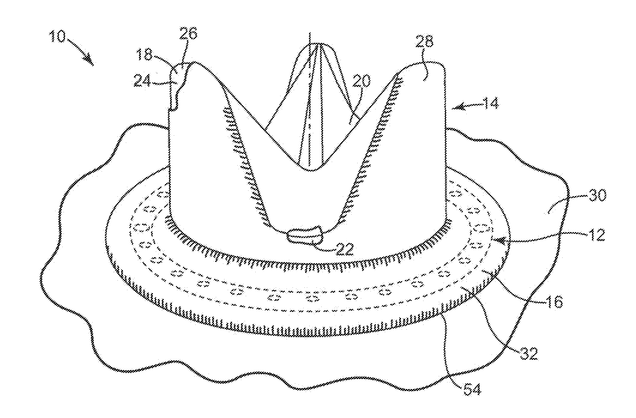 Pharmacological Delivery Implement for Use with Cardiac Repair Devices