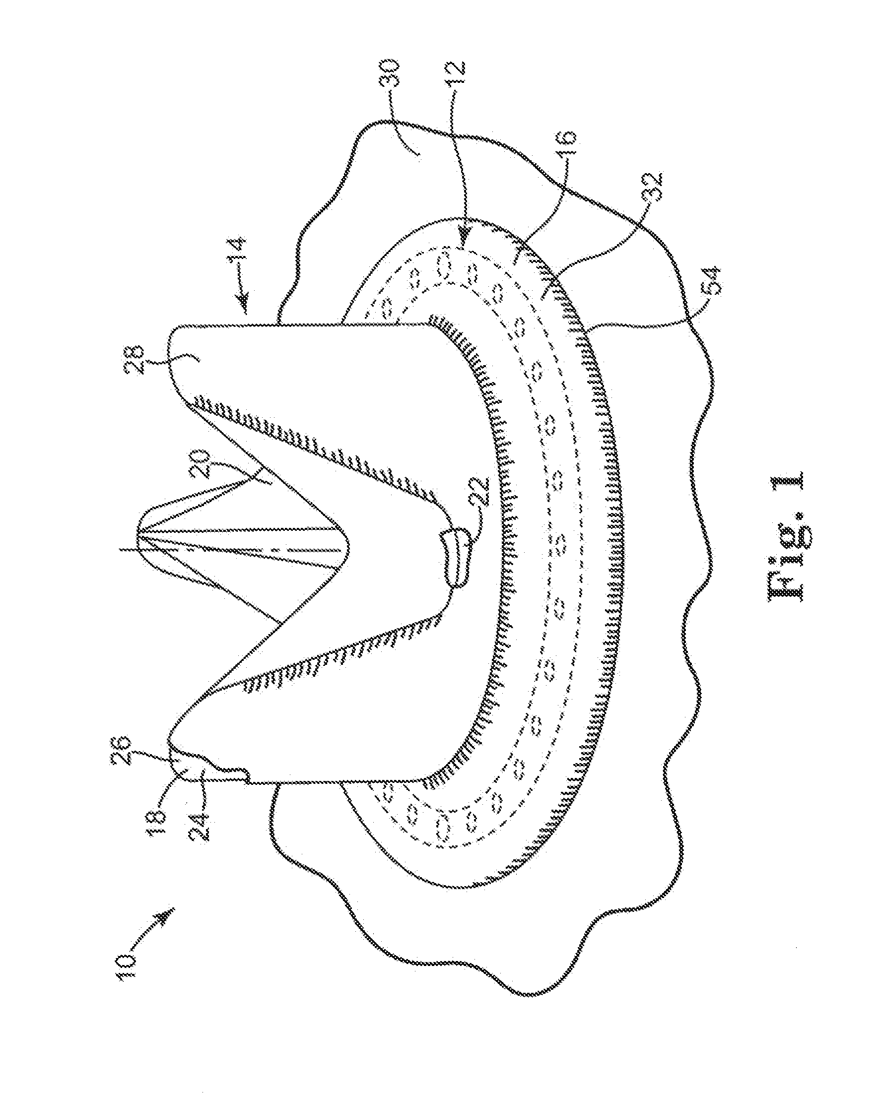 Pharmacological Delivery Implement for Use with Cardiac Repair Devices