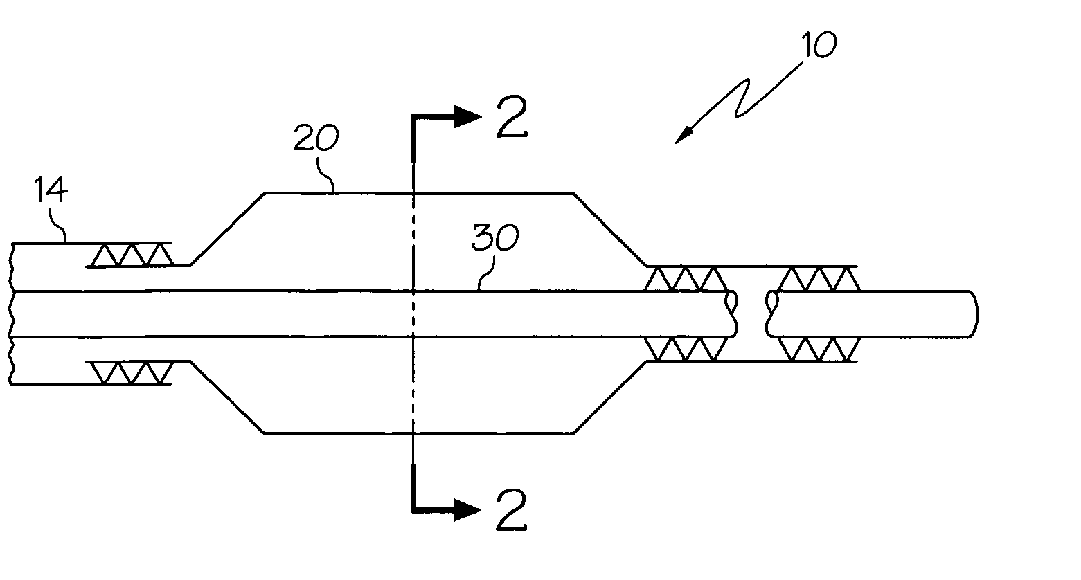 Balloon catheter with expandable wire lumen