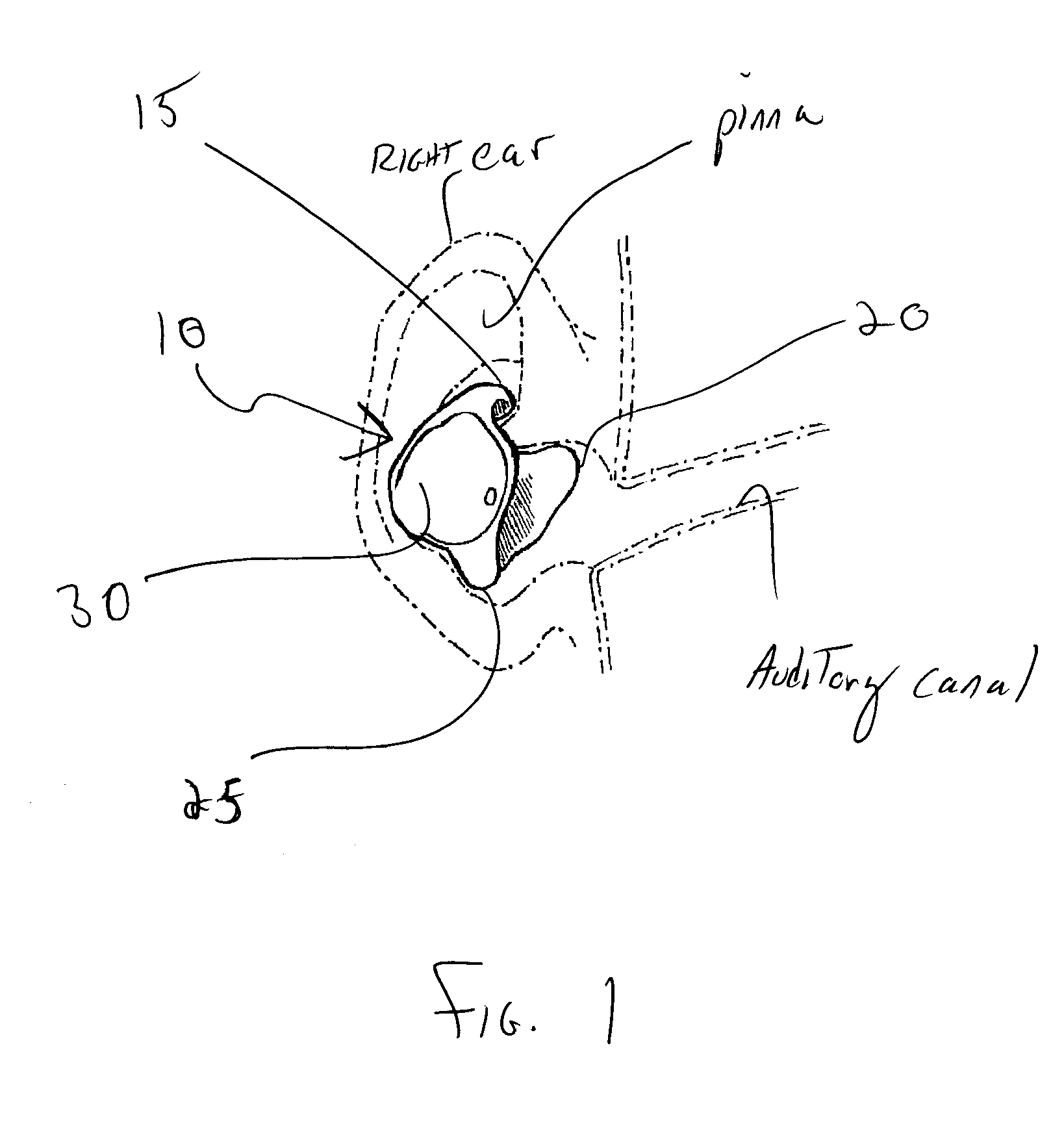 Ear device for improved fit and sound