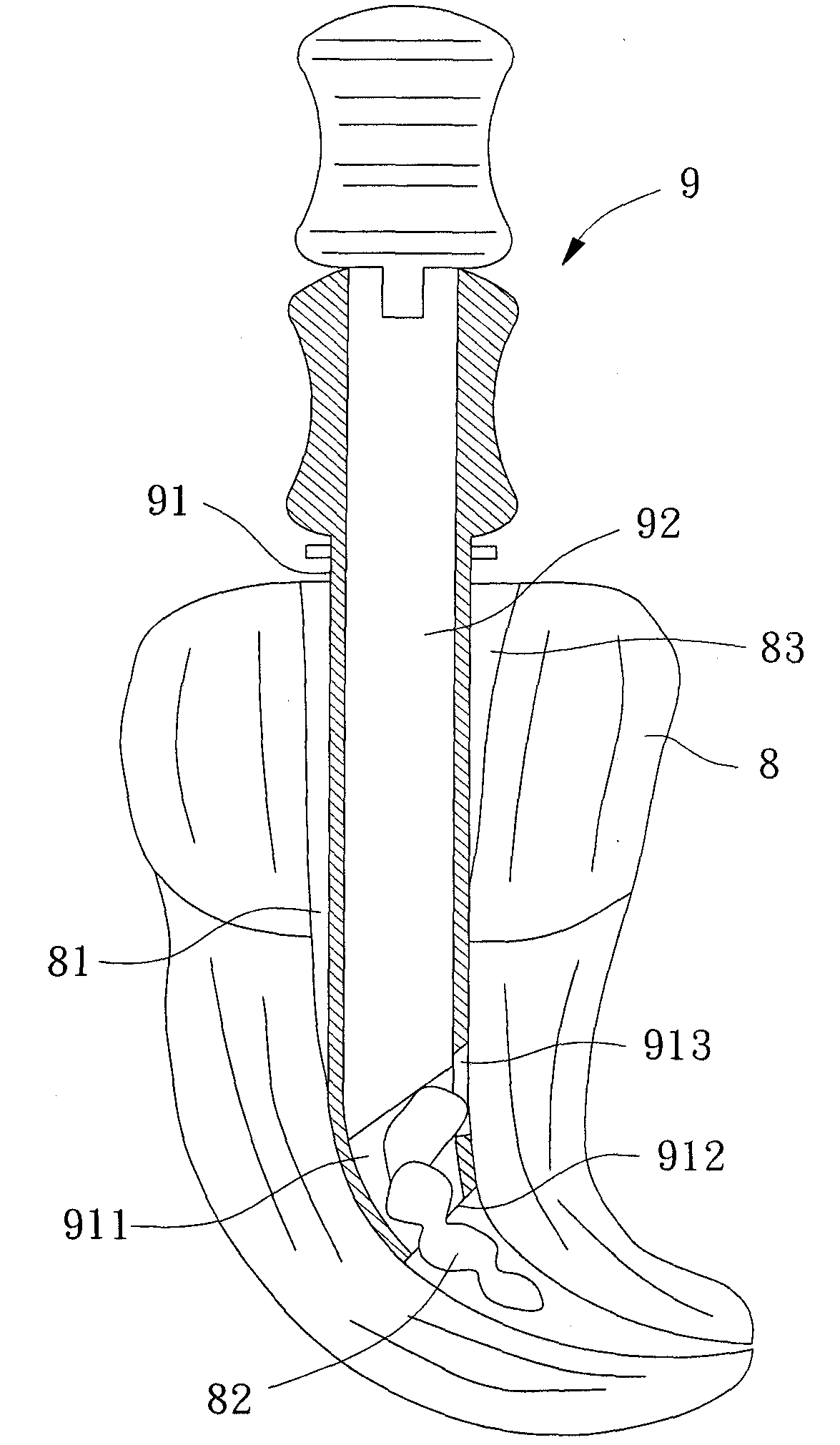 Removing device for root canal obstruction