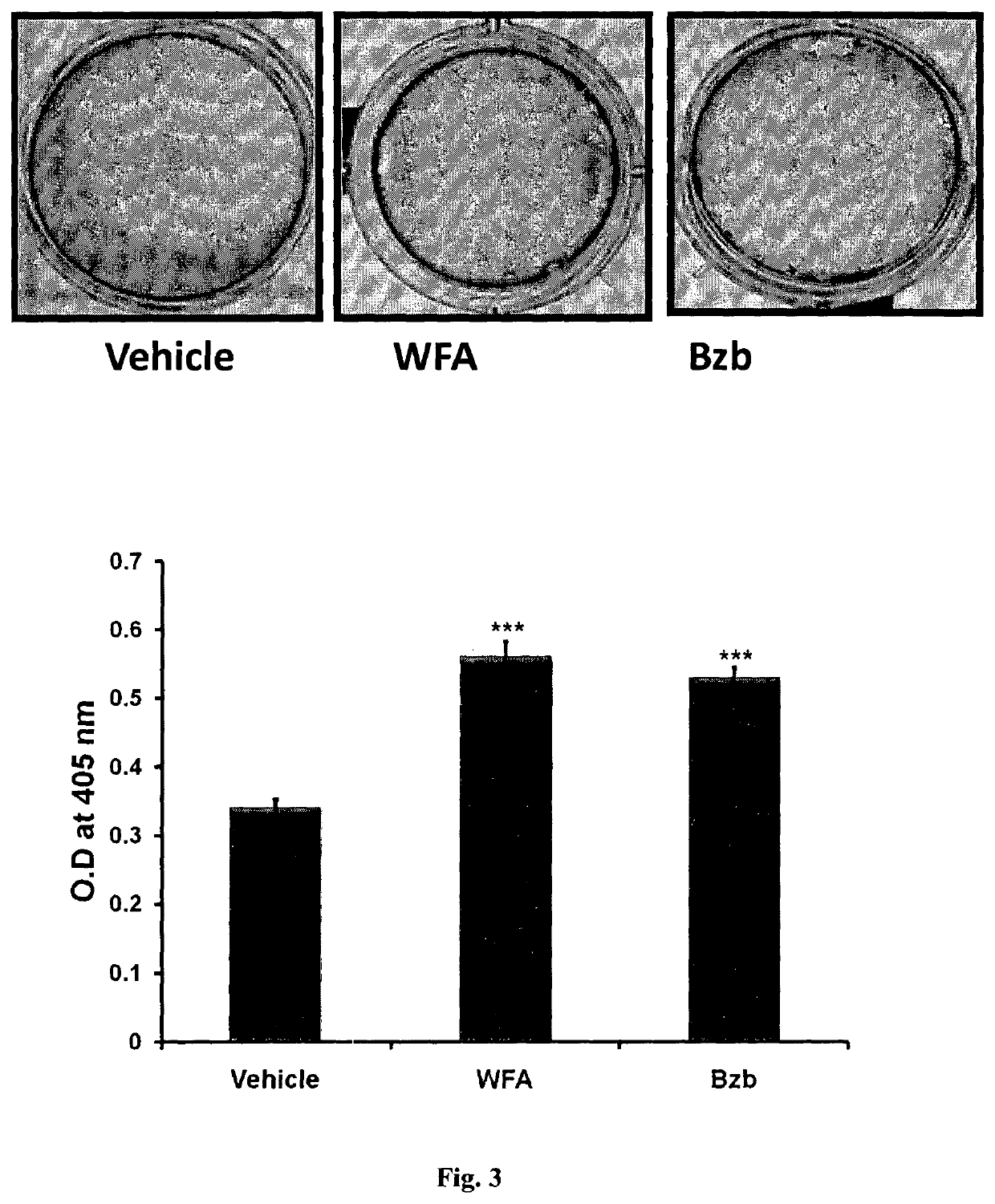 Pharmaceutical composition for the treatment of diminution of bone tissue