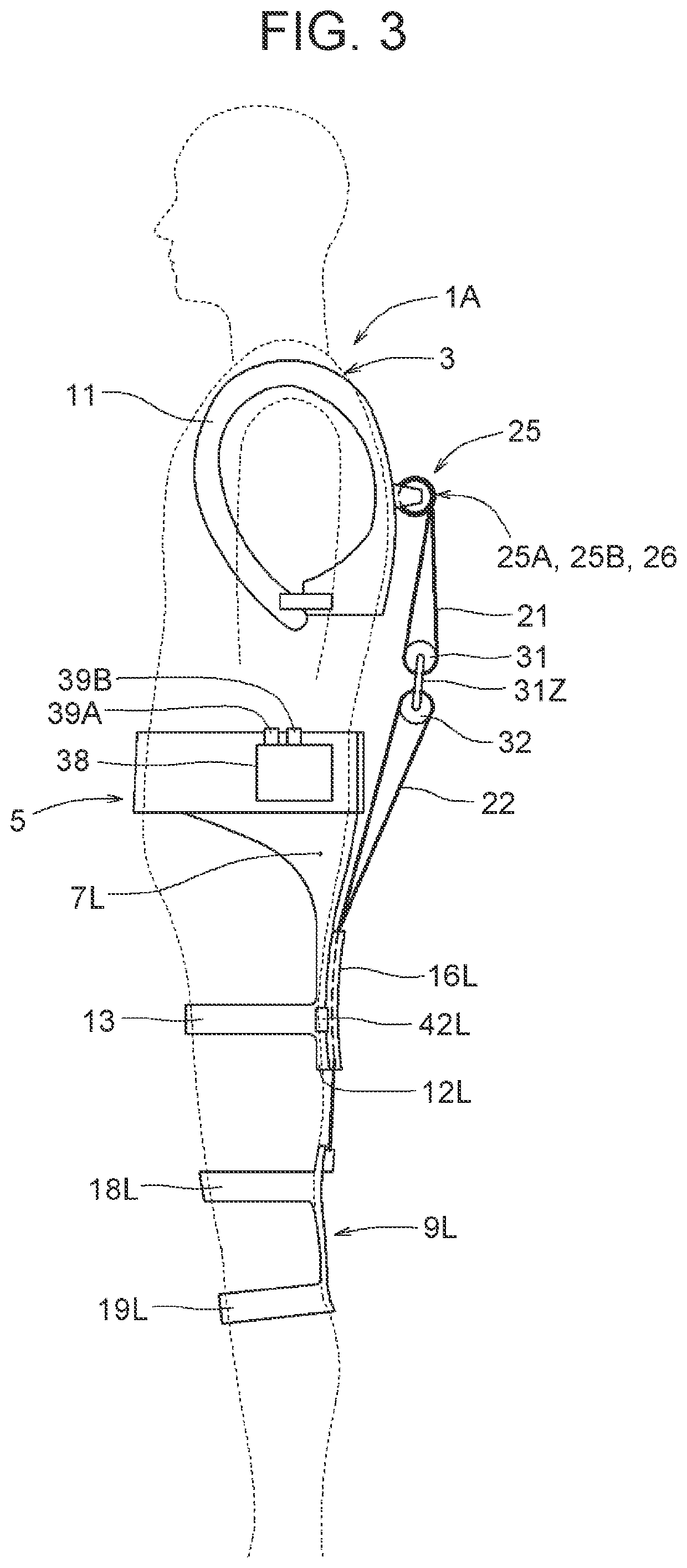 Assist apparatus