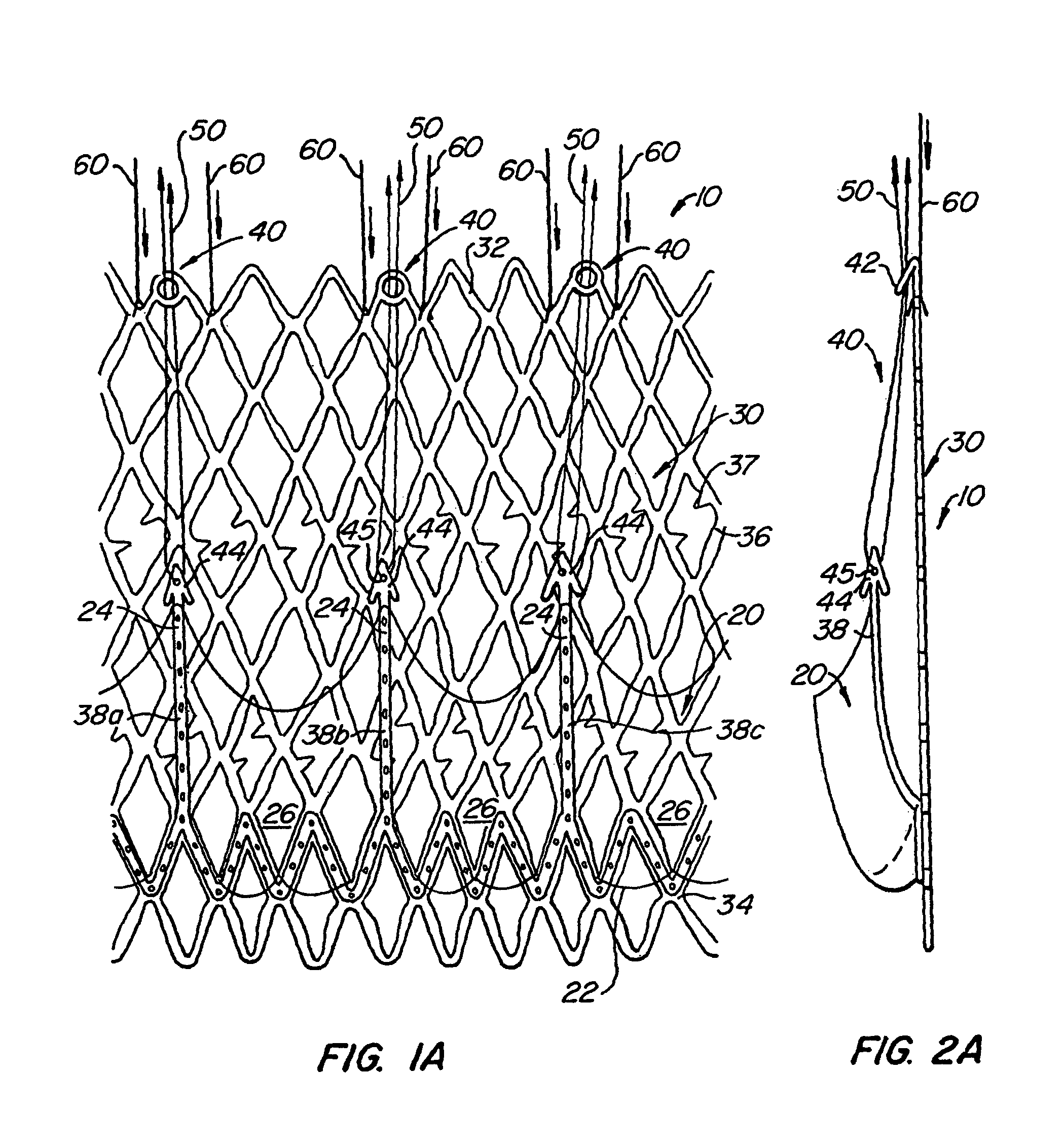 Replacement valve and anchor