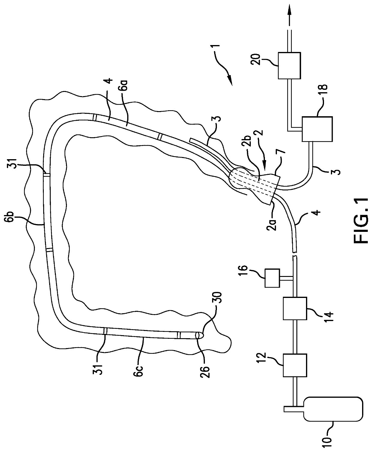 Luminal oxygen delivery and device for treating diseases and conditions associated with strict anaerobic microorganisms