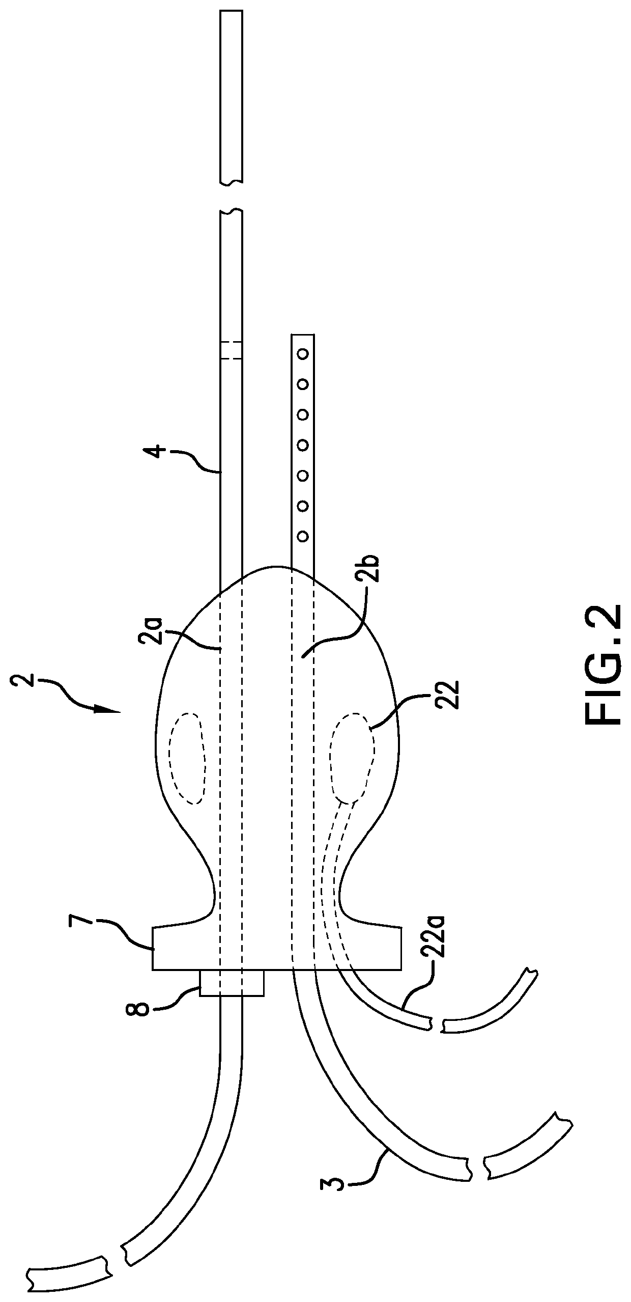 Luminal oxygen delivery and device for treating diseases and conditions associated with strict anaerobic microorganisms