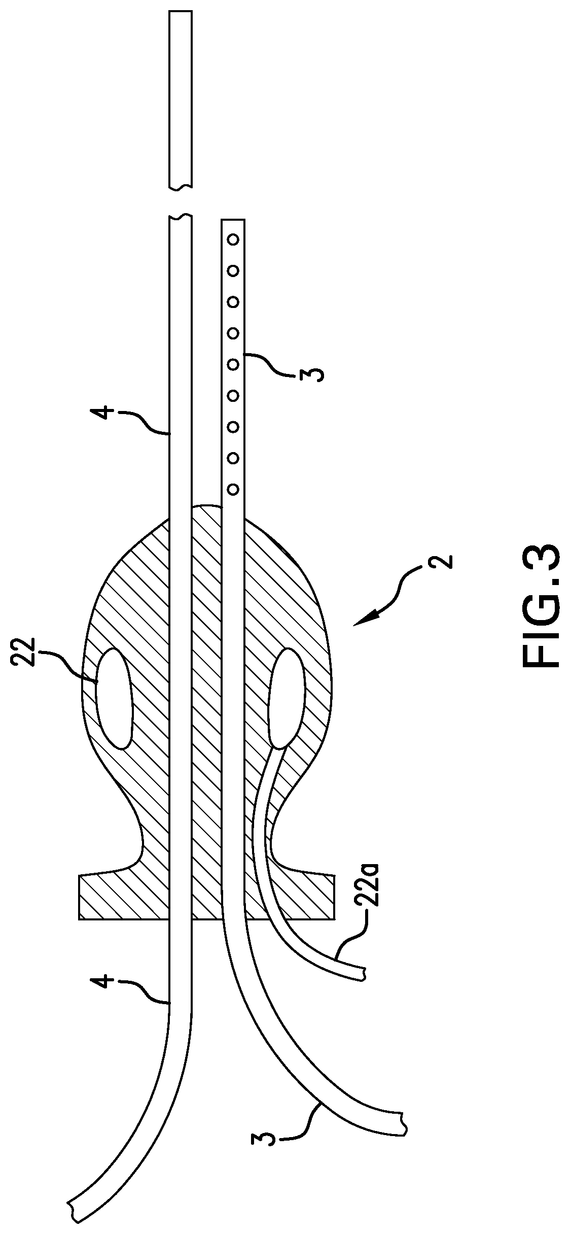 Luminal oxygen delivery and device for treating diseases and conditions associated with strict anaerobic microorganisms