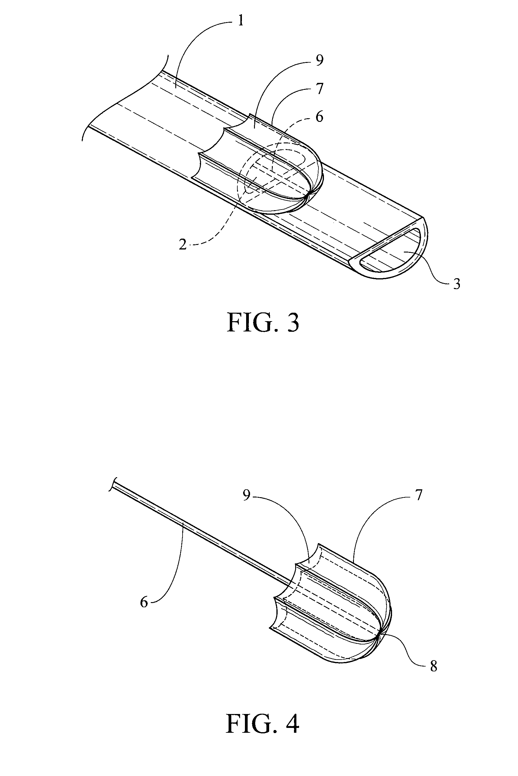 Hemodialysis catheter with thrombus blocker