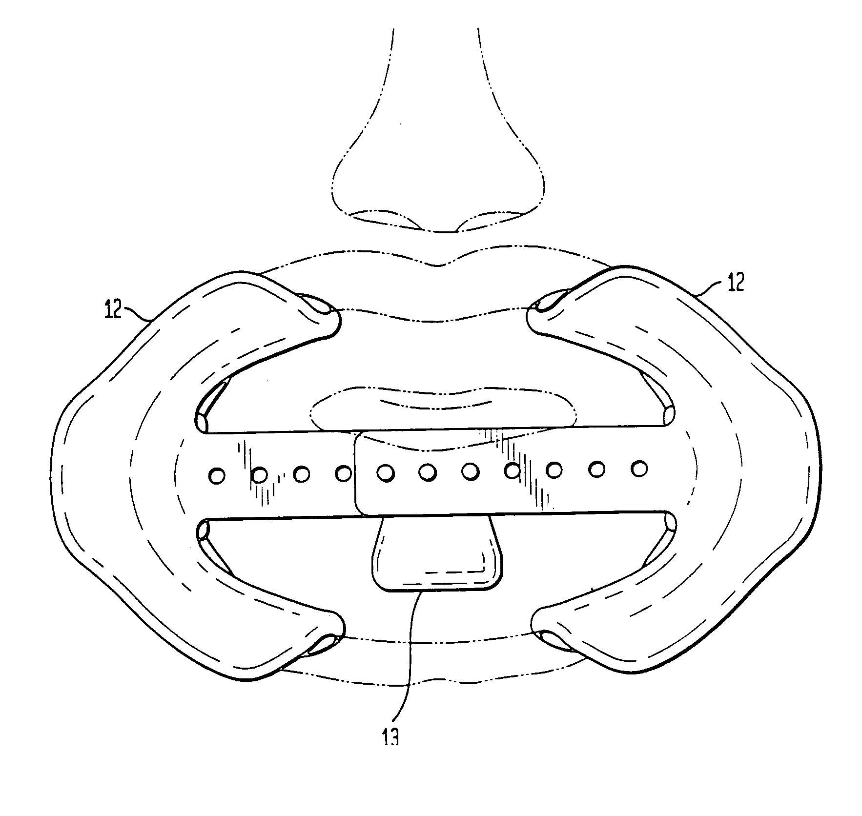 Dental retractor and method of use to produce anatomically accurate jaw models and dental prostheses