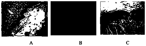 Composite collagen dressing for burnt injury wound surface restoration and preparation method thereof