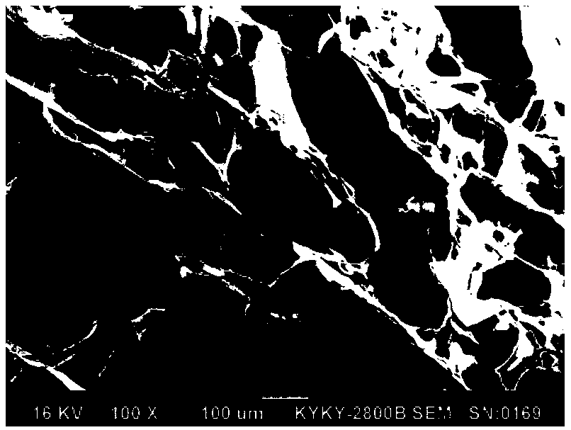 Composite collagen dressing for burnt injury wound surface restoration and preparation method thereof