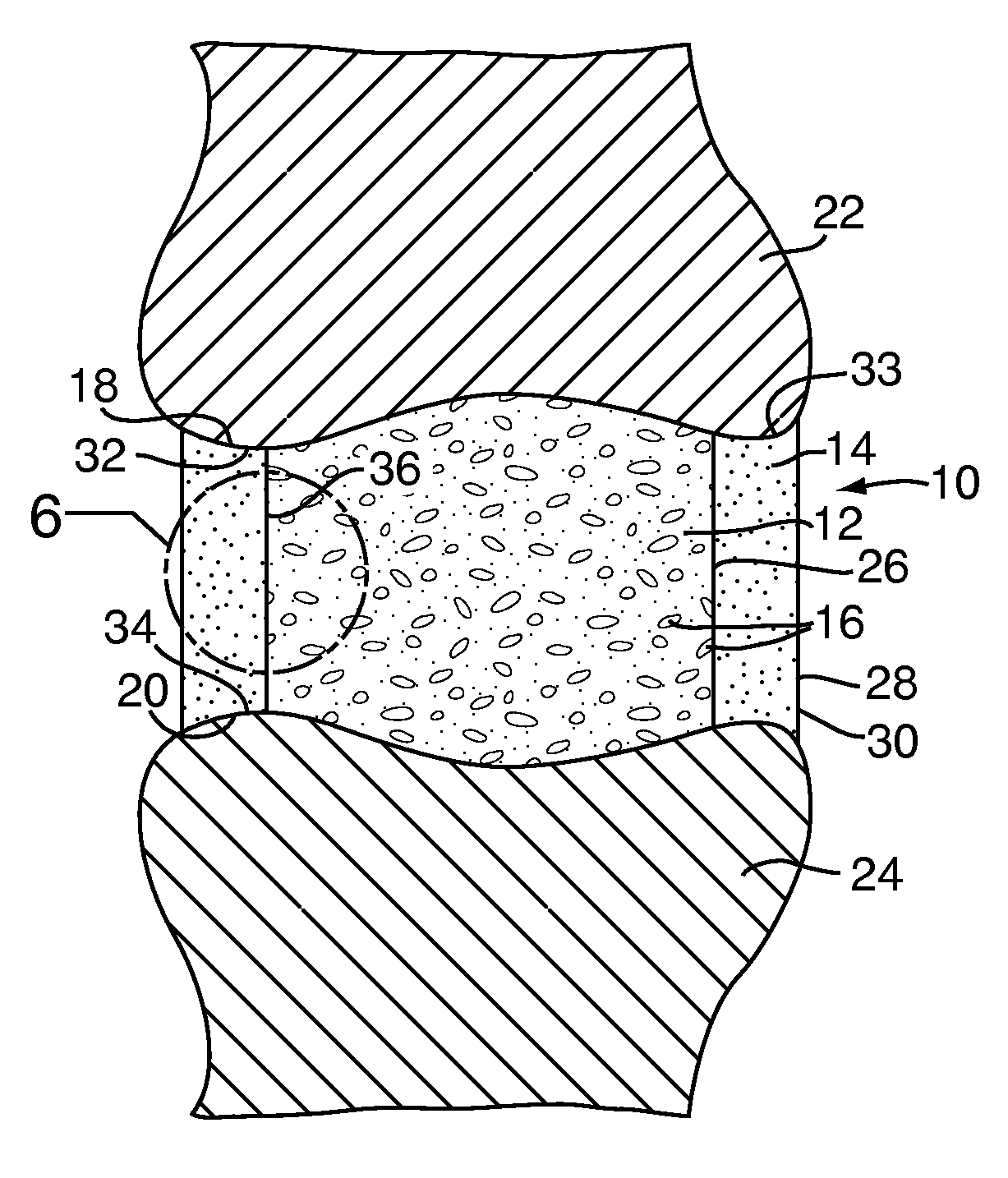 Multi-density polymeric interbody spacer