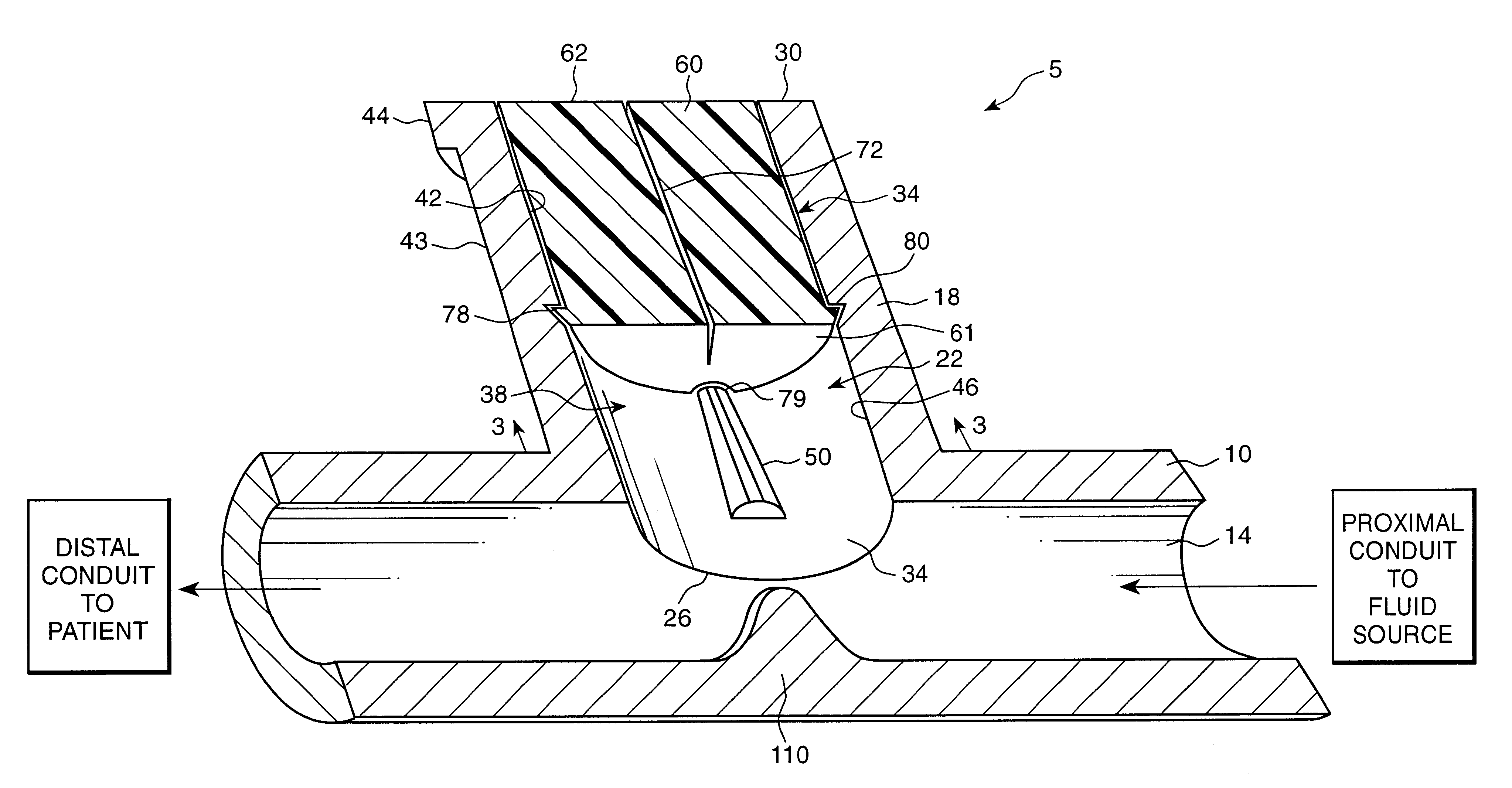 Luer-receiving medical valve and fluid transfer method