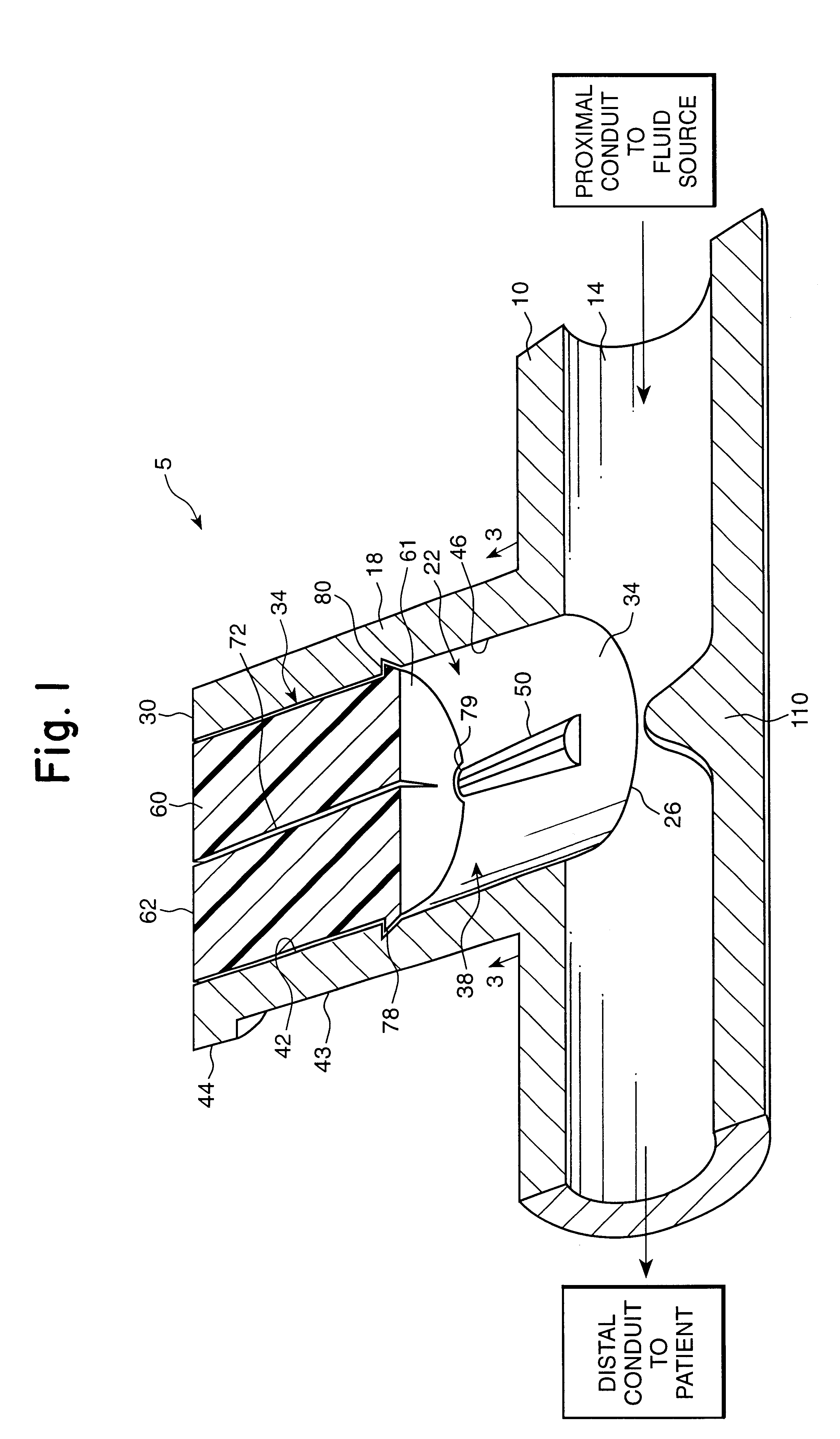 Luer-receiving medical valve and fluid transfer method