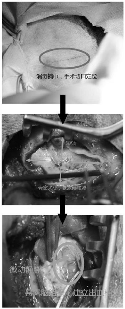 Method for constructing canine cerebral hemorrhage model