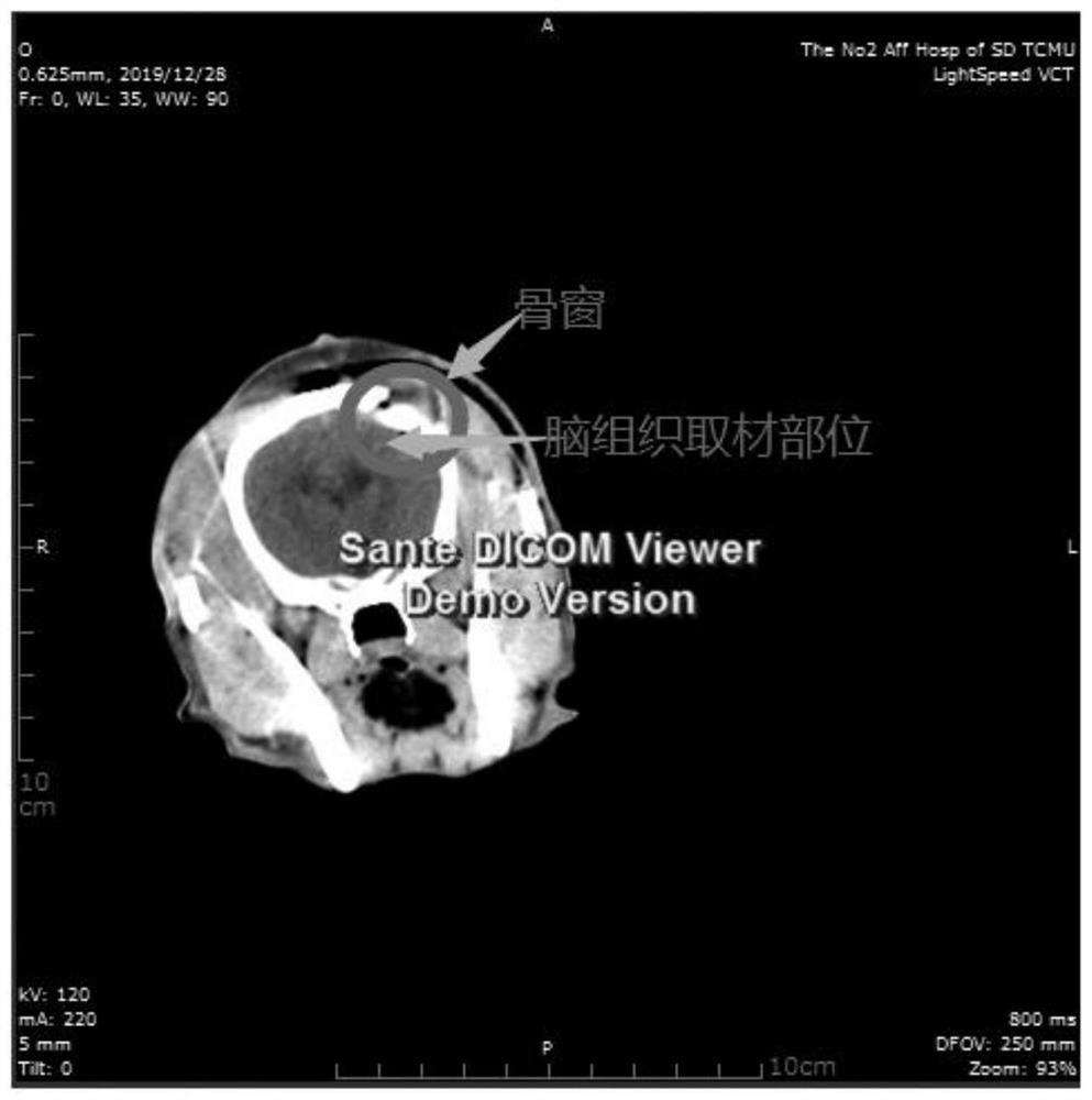 Method for constructing canine cerebral hemorrhage model