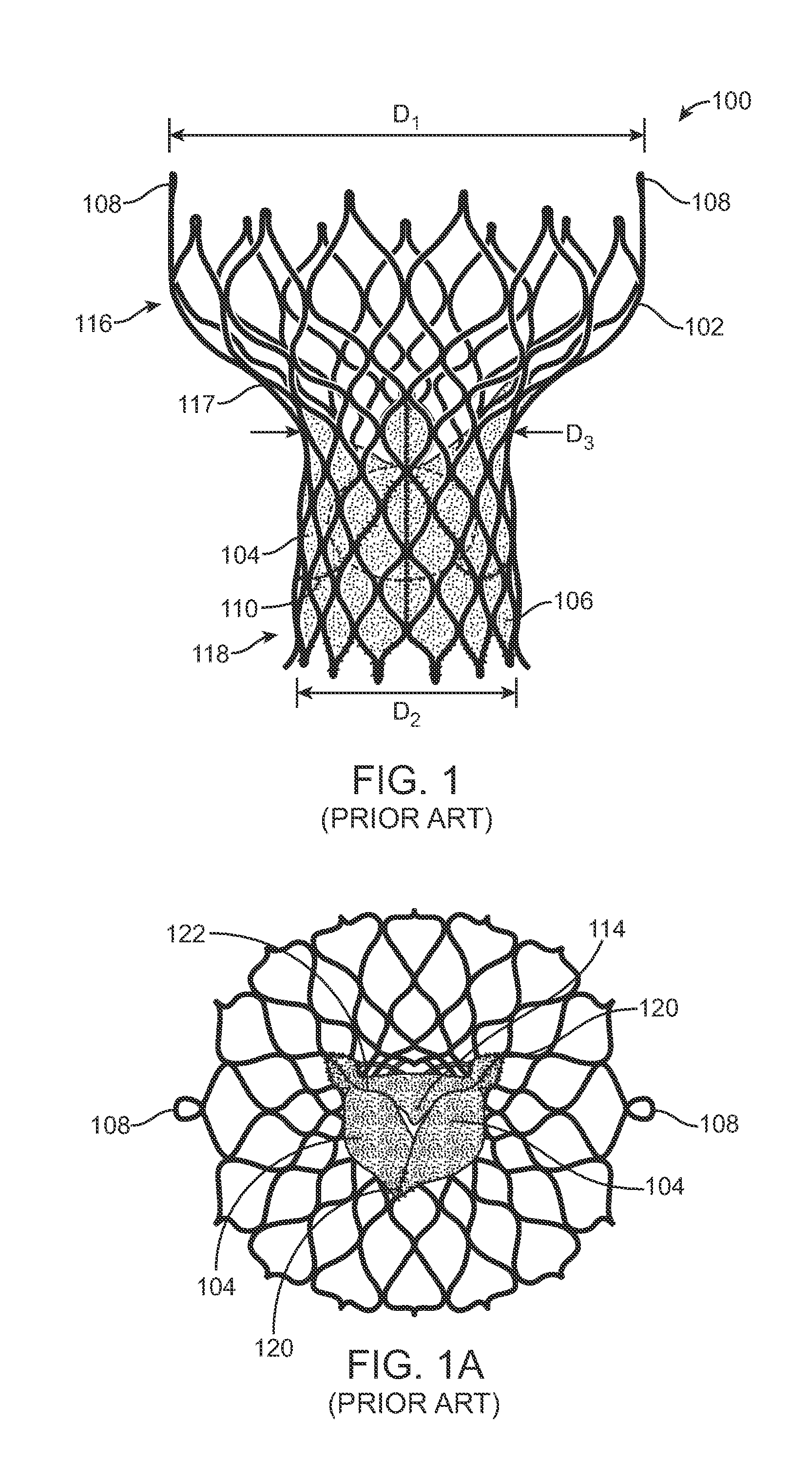 Anti-Paravalvular Leakage Components for a Transcatheter Valve Prosthesis