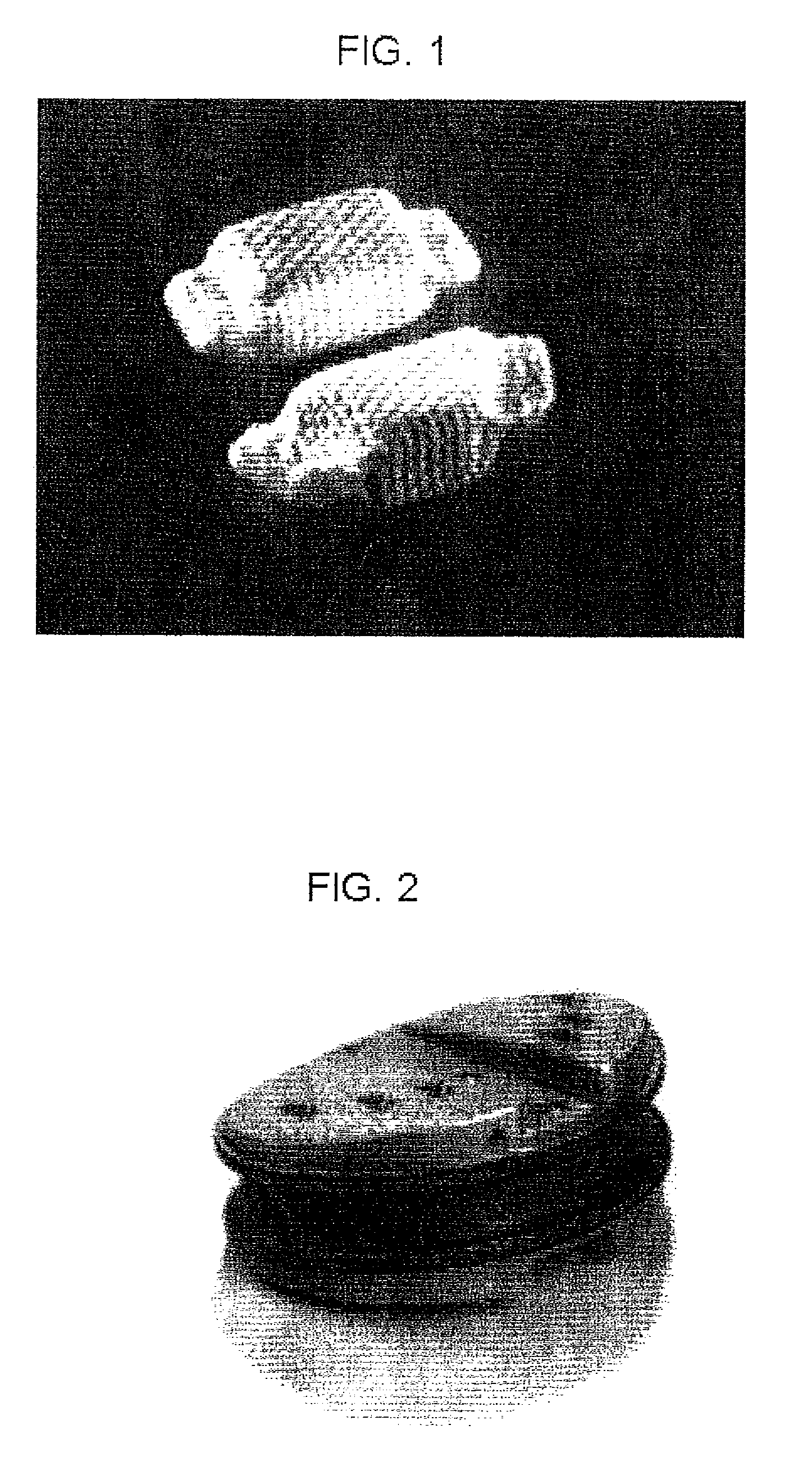 Dynamic spinal implants incorporating cartilage bearing graft material