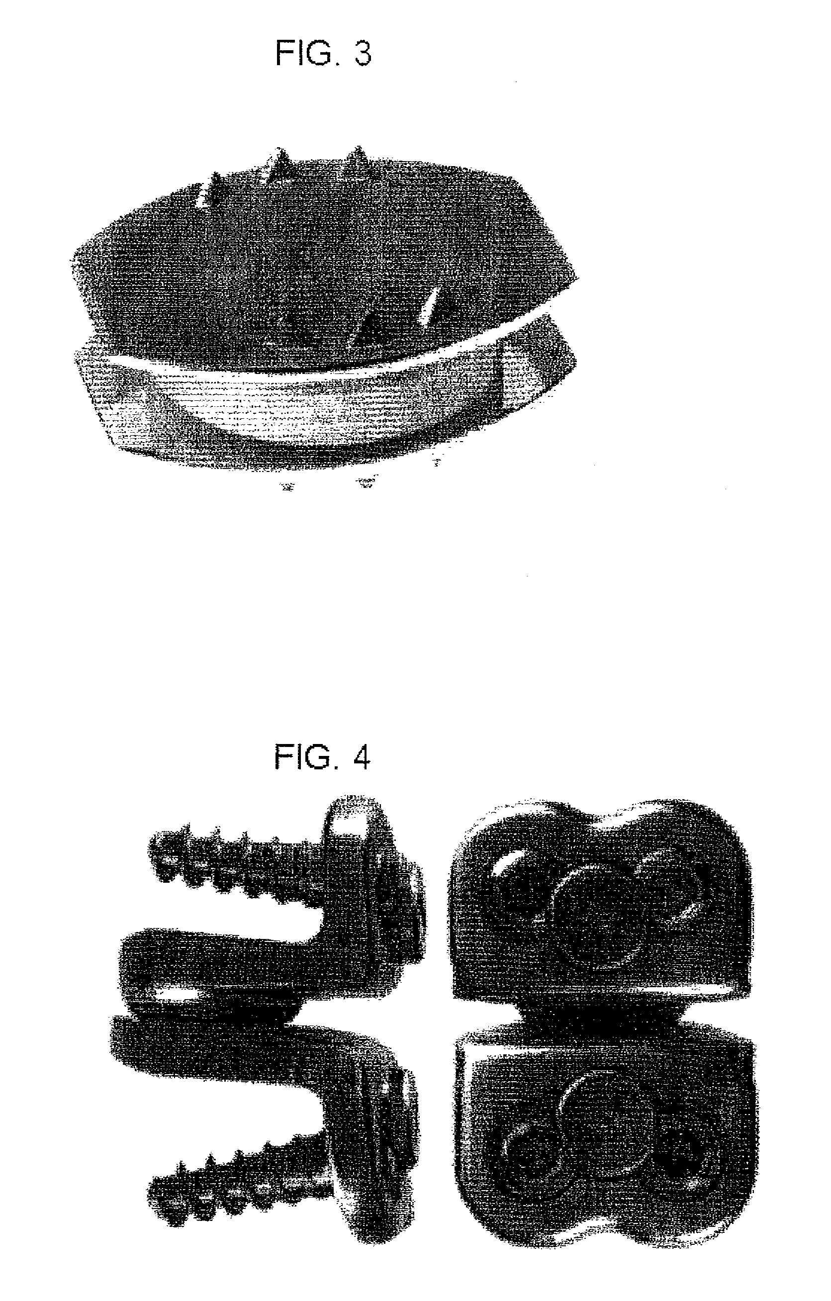 Dynamic spinal implants incorporating cartilage bearing graft material