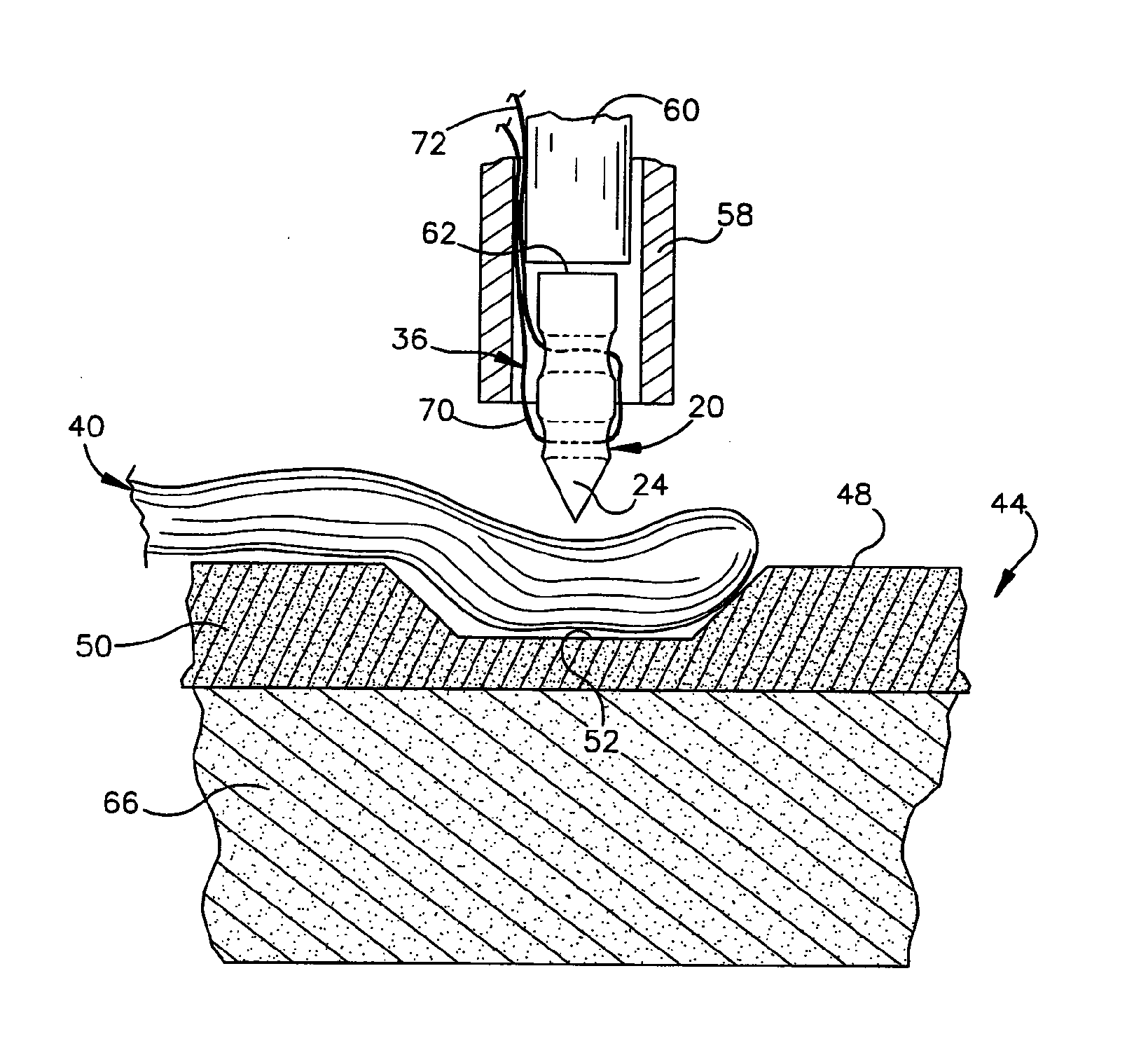 Method of connecting body tissue to a bone