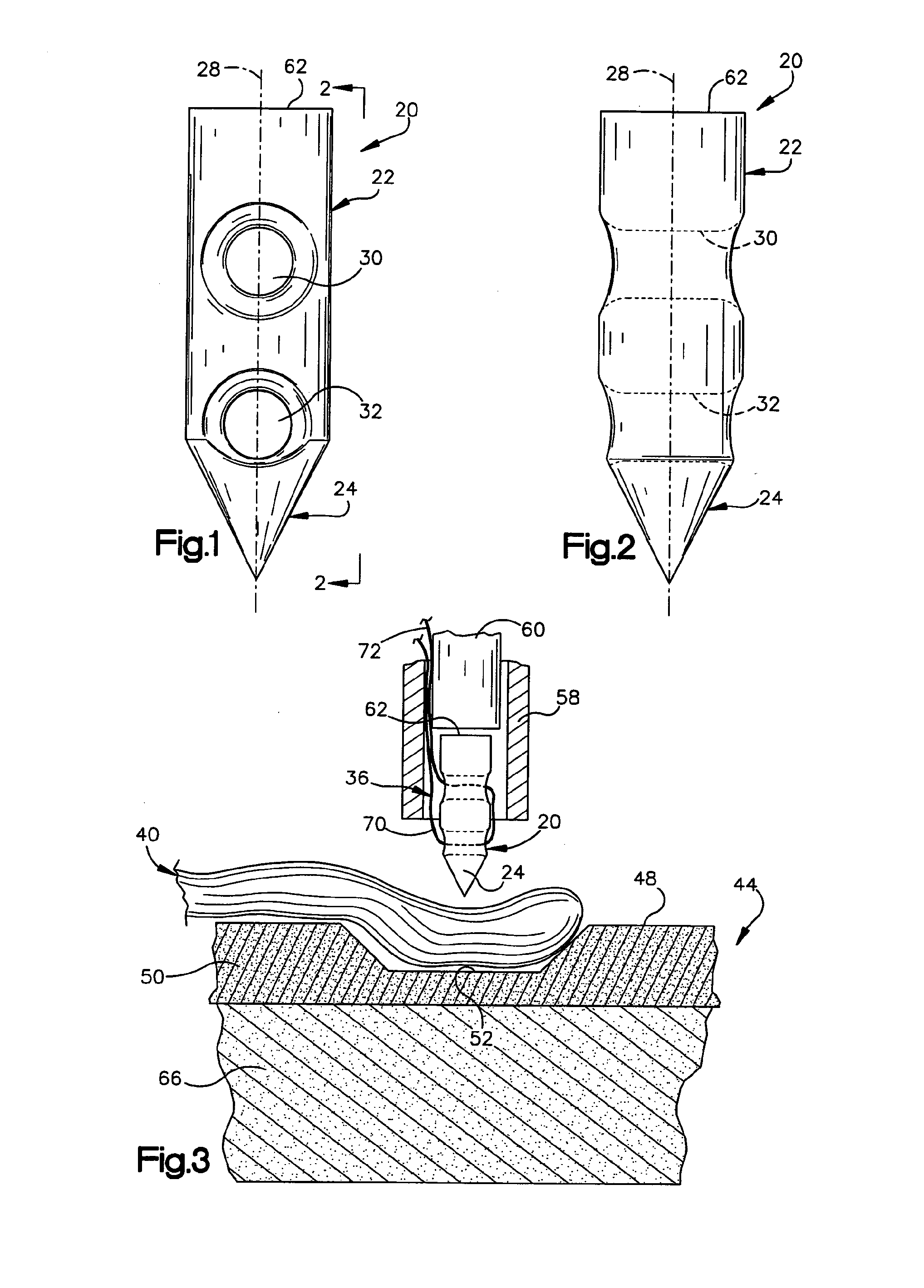 Method of connecting body tissue to a bone