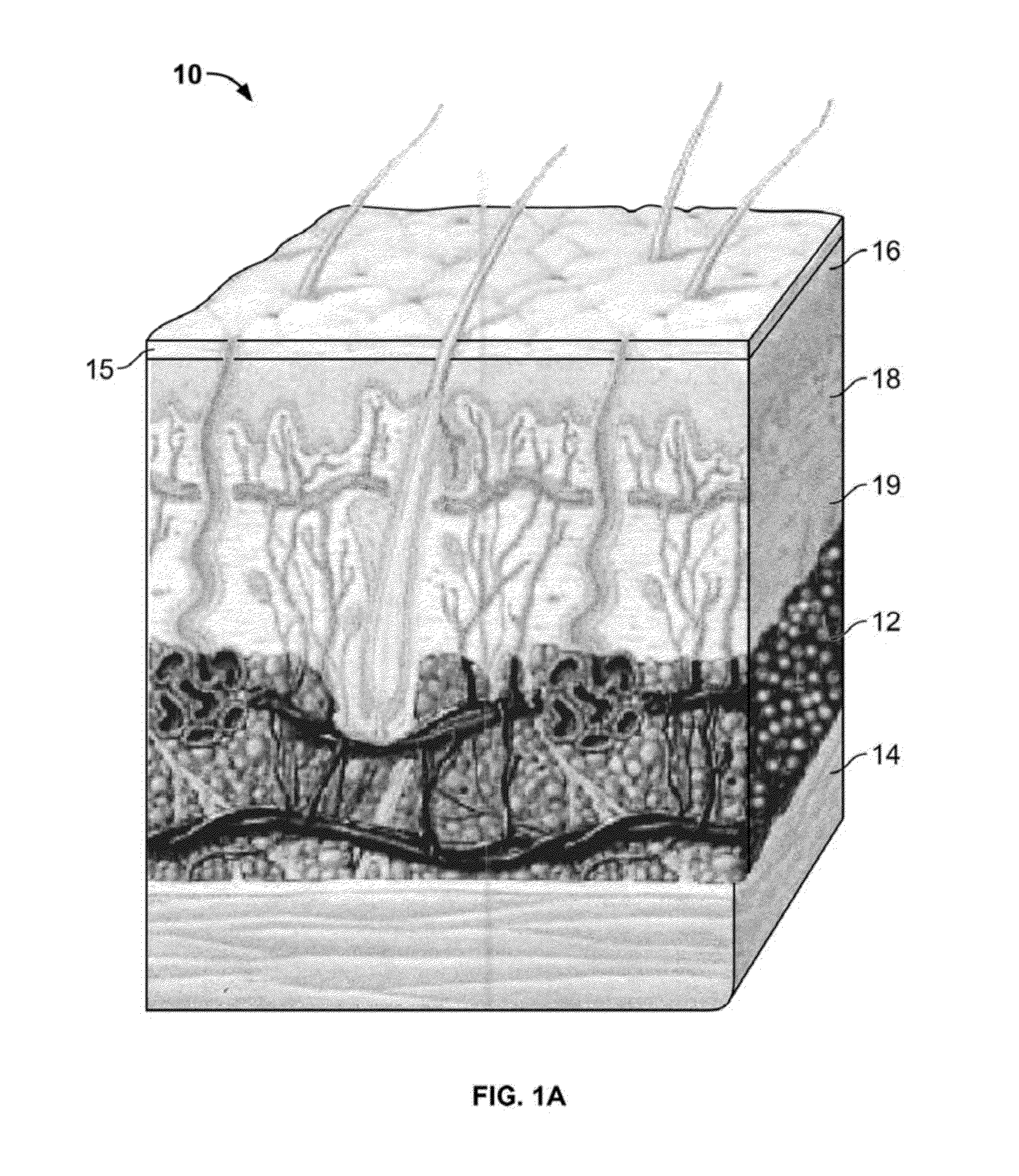 Devices and methods for percutaneous energy delivery