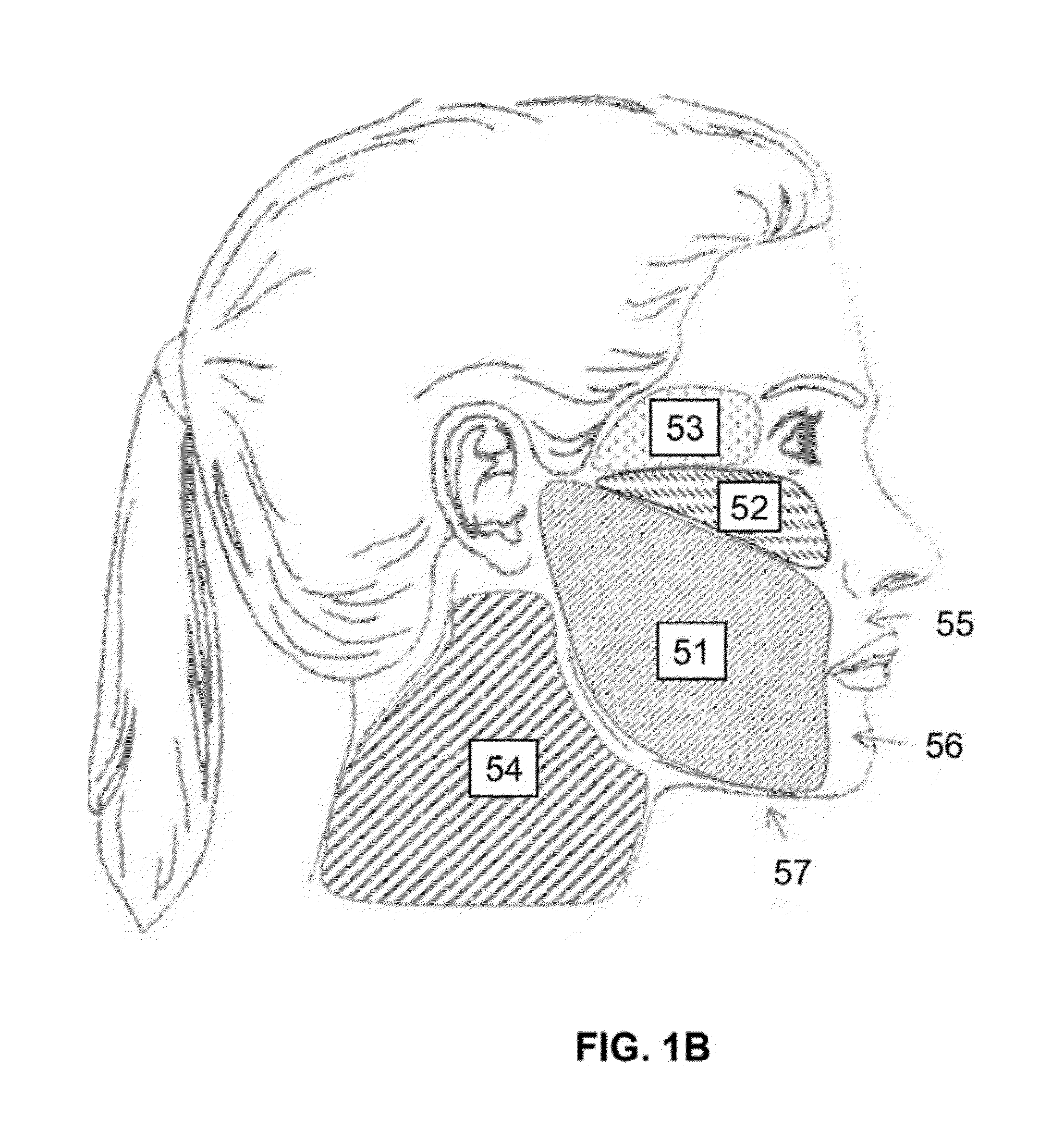 Devices and methods for percutaneous energy delivery