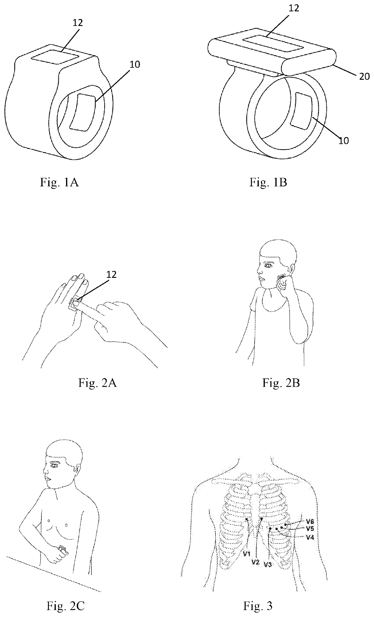 Wearable electrocardiographic measurement device