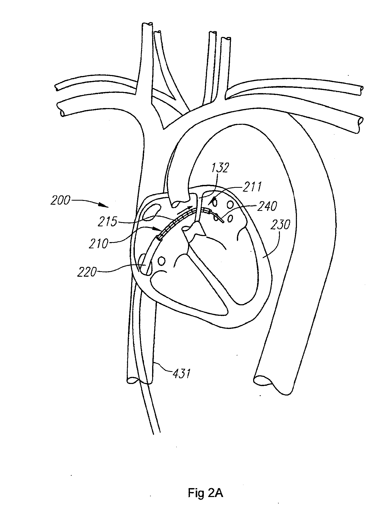 Instrument systems and methods utilizing optical fiber sensor