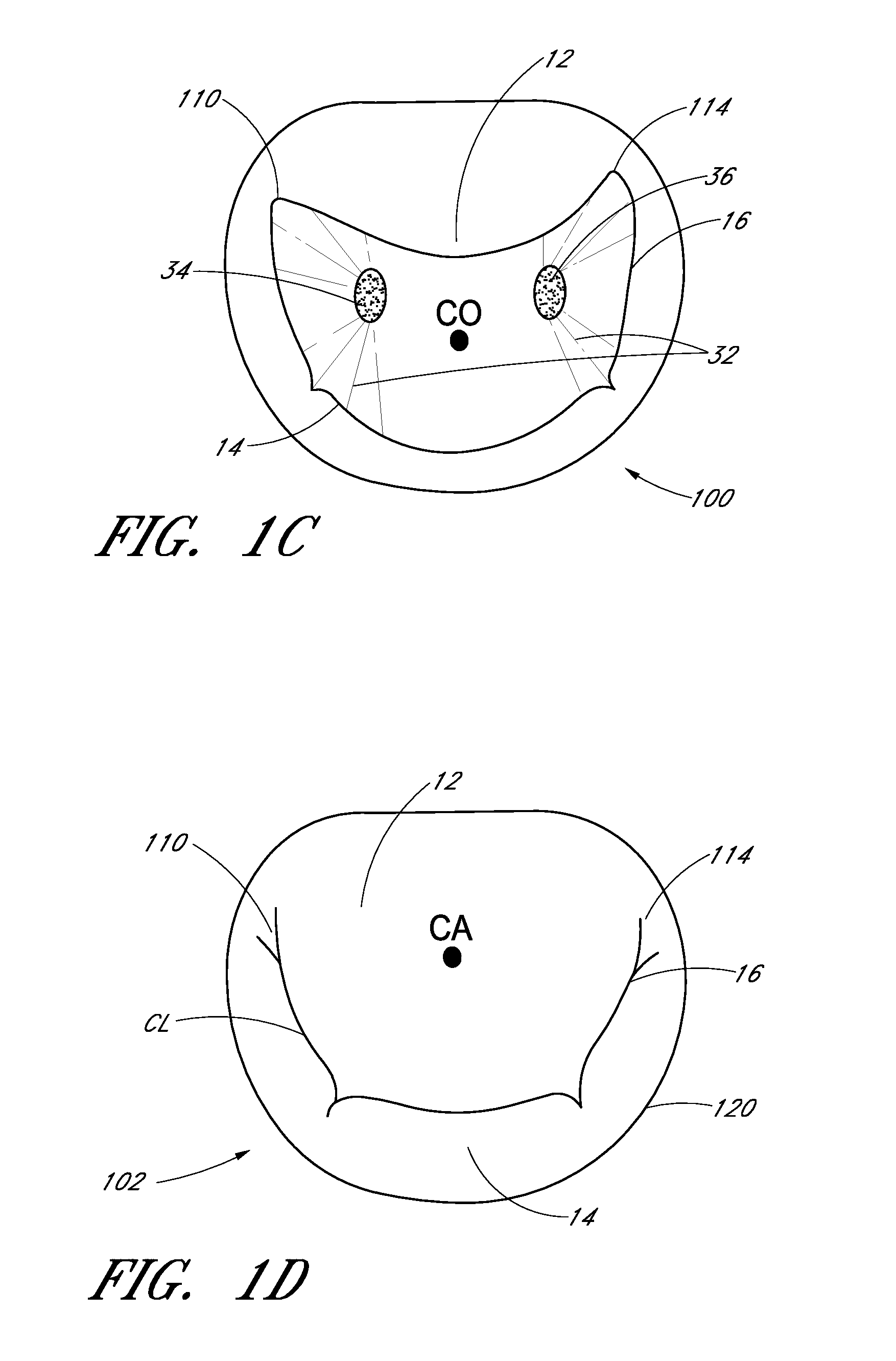 Device, system, and method for transcatheter treatment of valve regurgitation