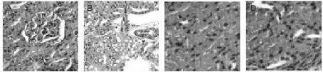 Application of tetramethylpyrazine to preparation of medicine for treating contrast-induced nephropathy