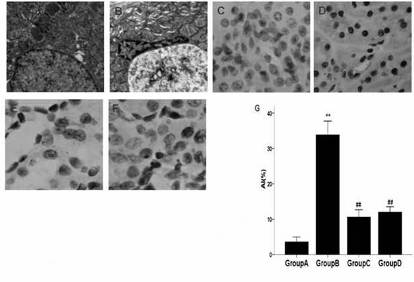 Application of tetramethylpyrazine to preparation of medicine for treating contrast-induced nephropathy