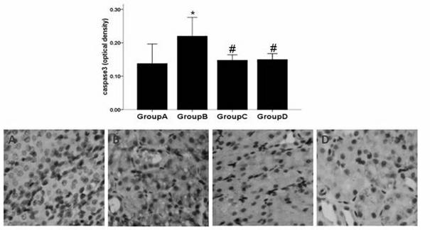 Application of tetramethylpyrazine to preparation of medicine for treating contrast-induced nephropathy