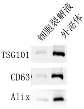 Colorectum-targeted drug-loaded exosome and application thereof, and drug for treating colorectal diseases