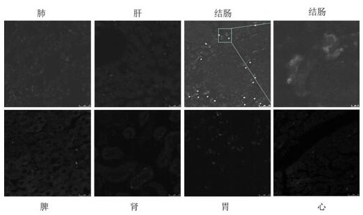 Colorectum-targeted drug-loaded exosome and application thereof, and drug for treating colorectal diseases