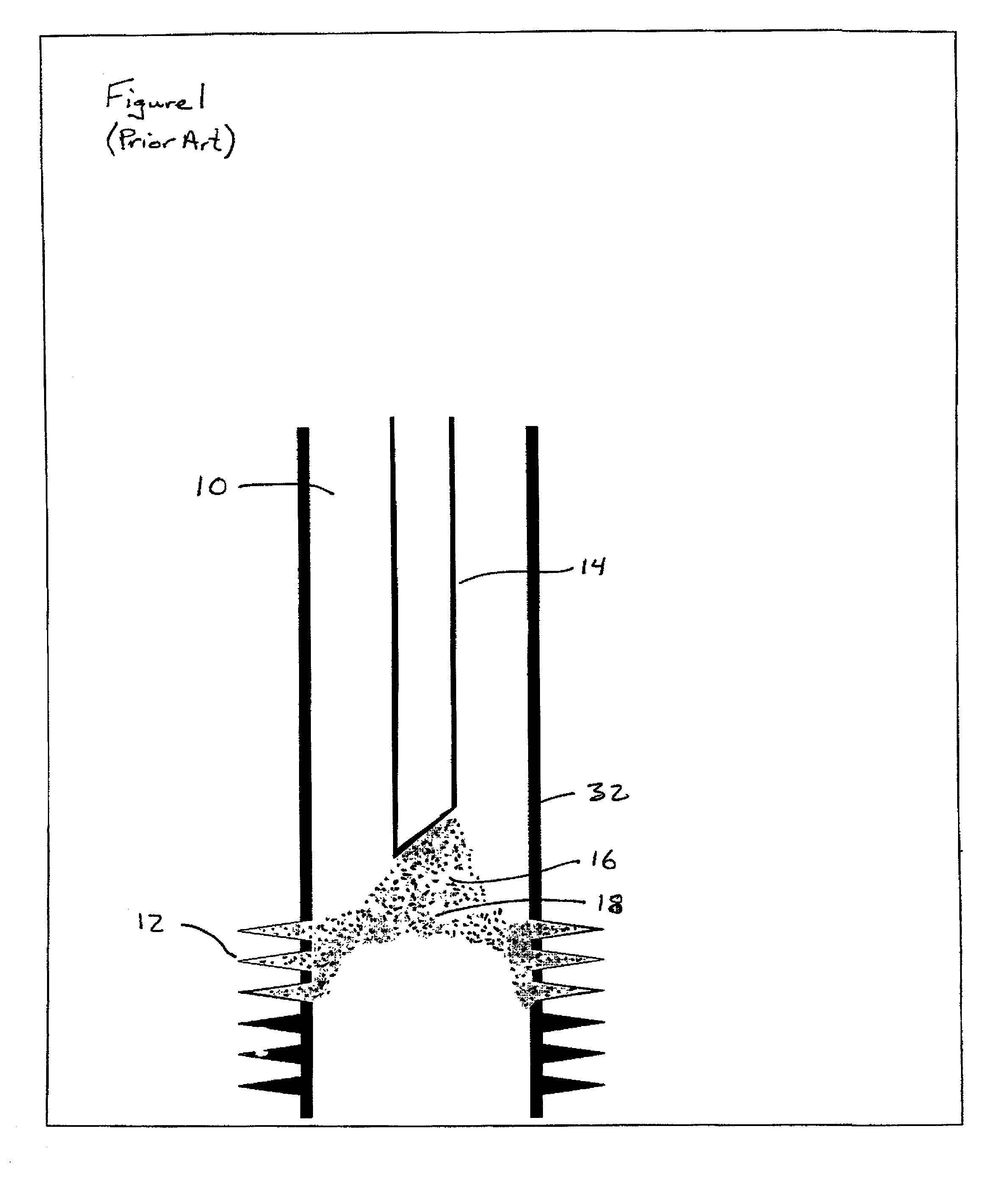 Sand control method and apparatus