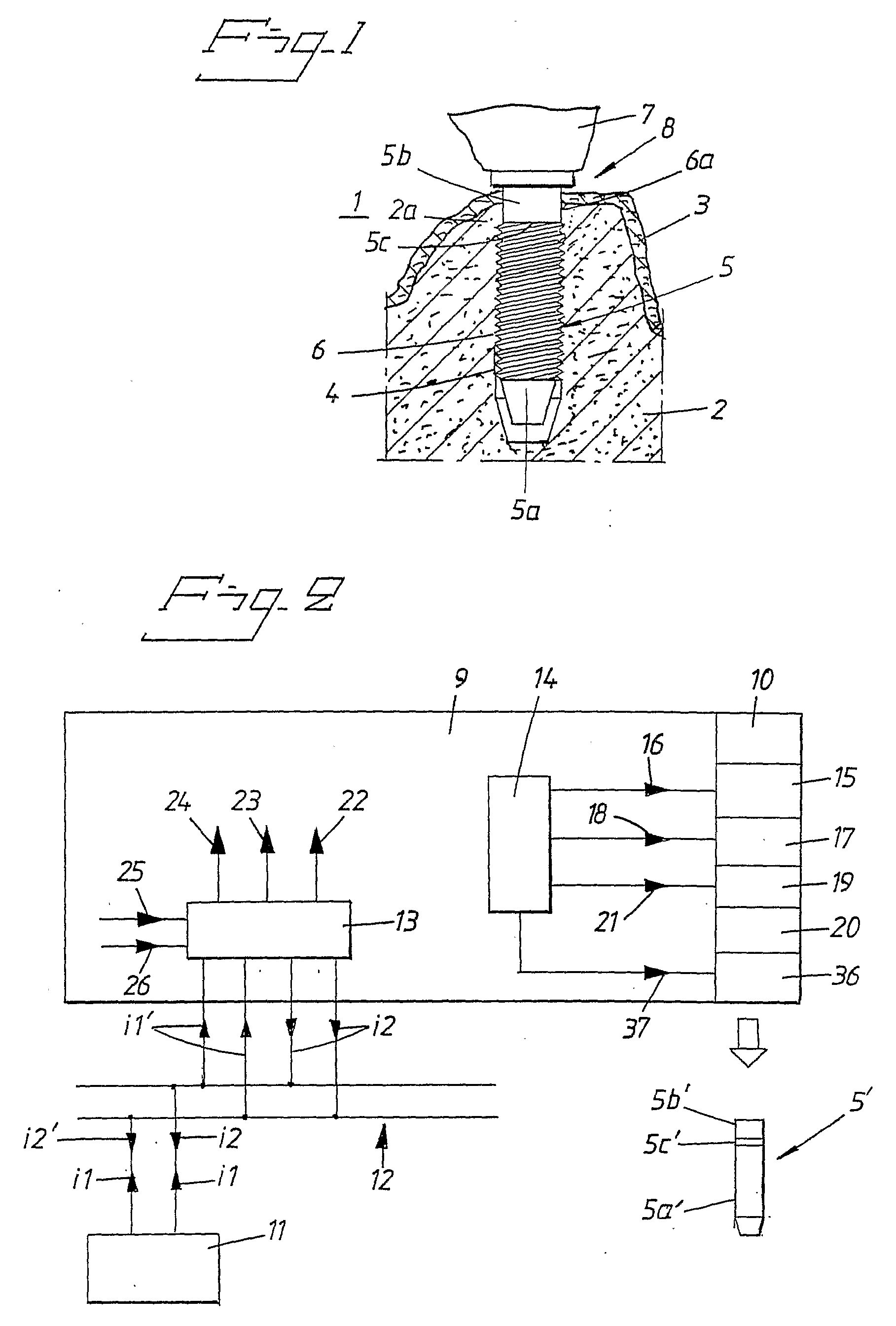 Implant For Dental Prosthesis, And Method And System For Producing The Implant