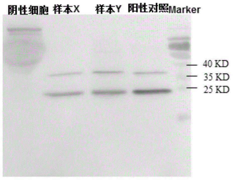 Qualitative and quantitative foot and mouth disease virus antigen detection method