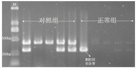 Method and kit for sensitively detecting human EGFR (epidermal growth factor receptor) gene mutation on basis of Sanger sequencing