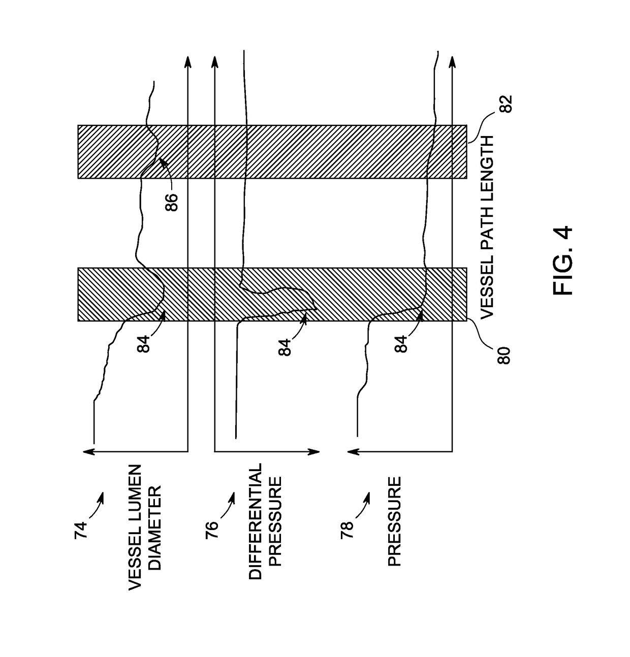 System and method for estimating vascular flow using CT imaging