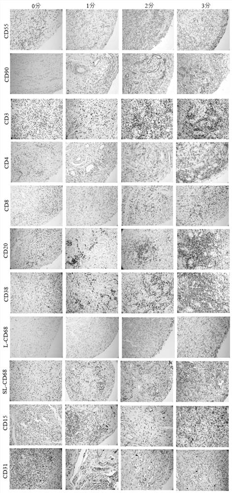 System for predicting one-year joint damage progress of rheumatoid arthritis patient