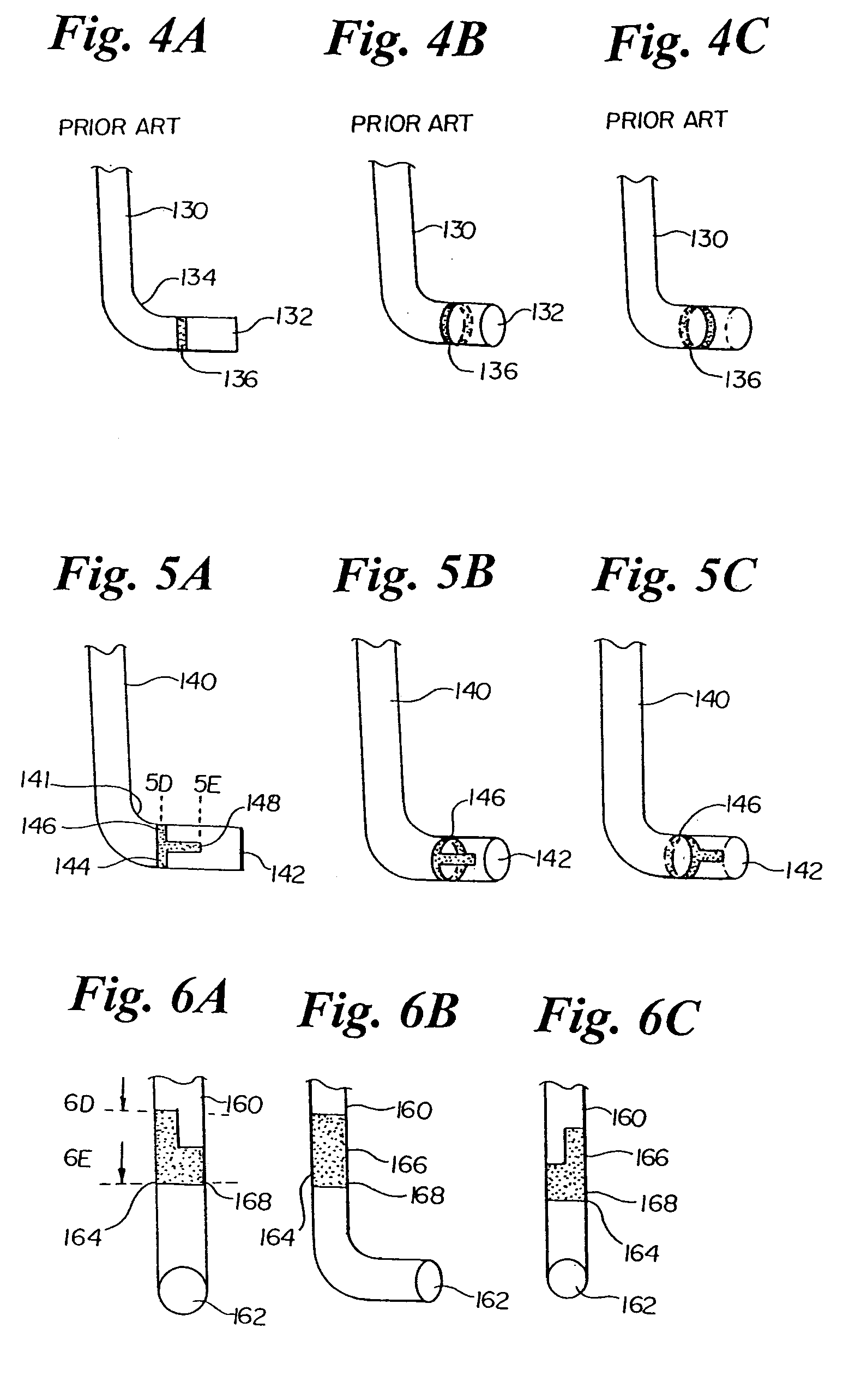 Infusion device and method