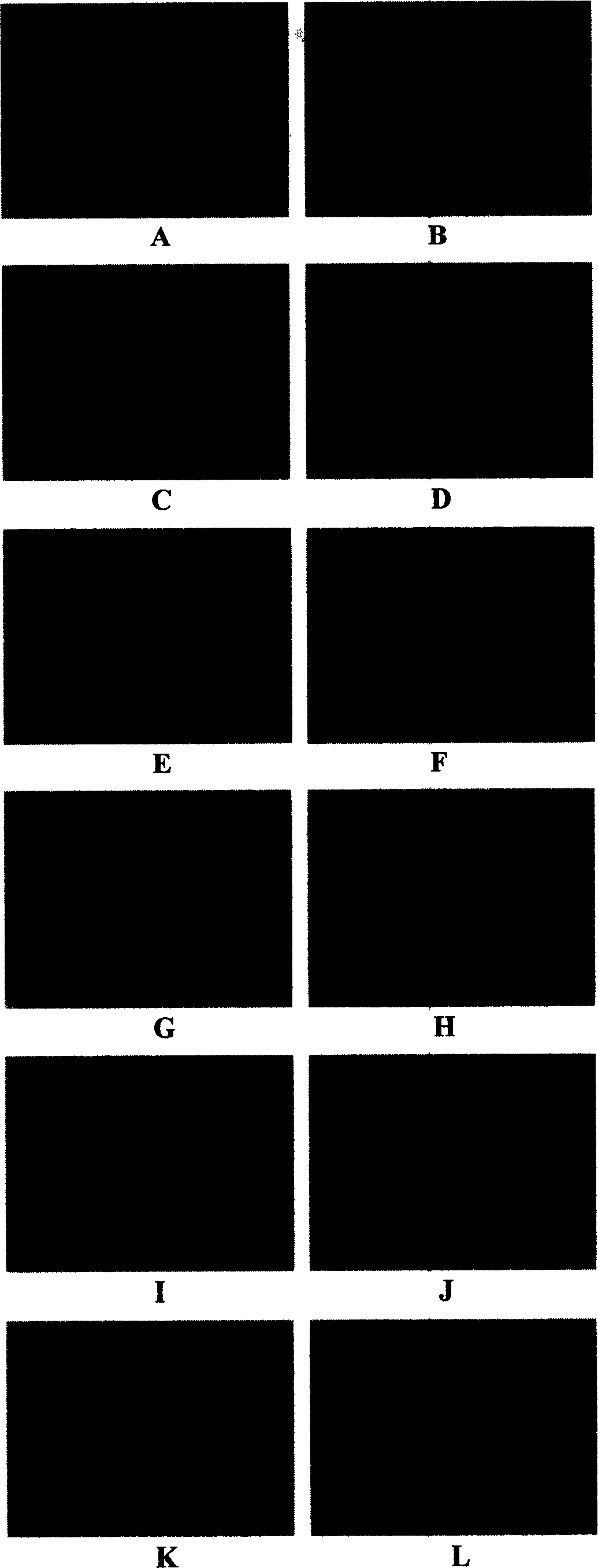 Attenuated vaccinia virus Tiantan strain vector and its preparation and application