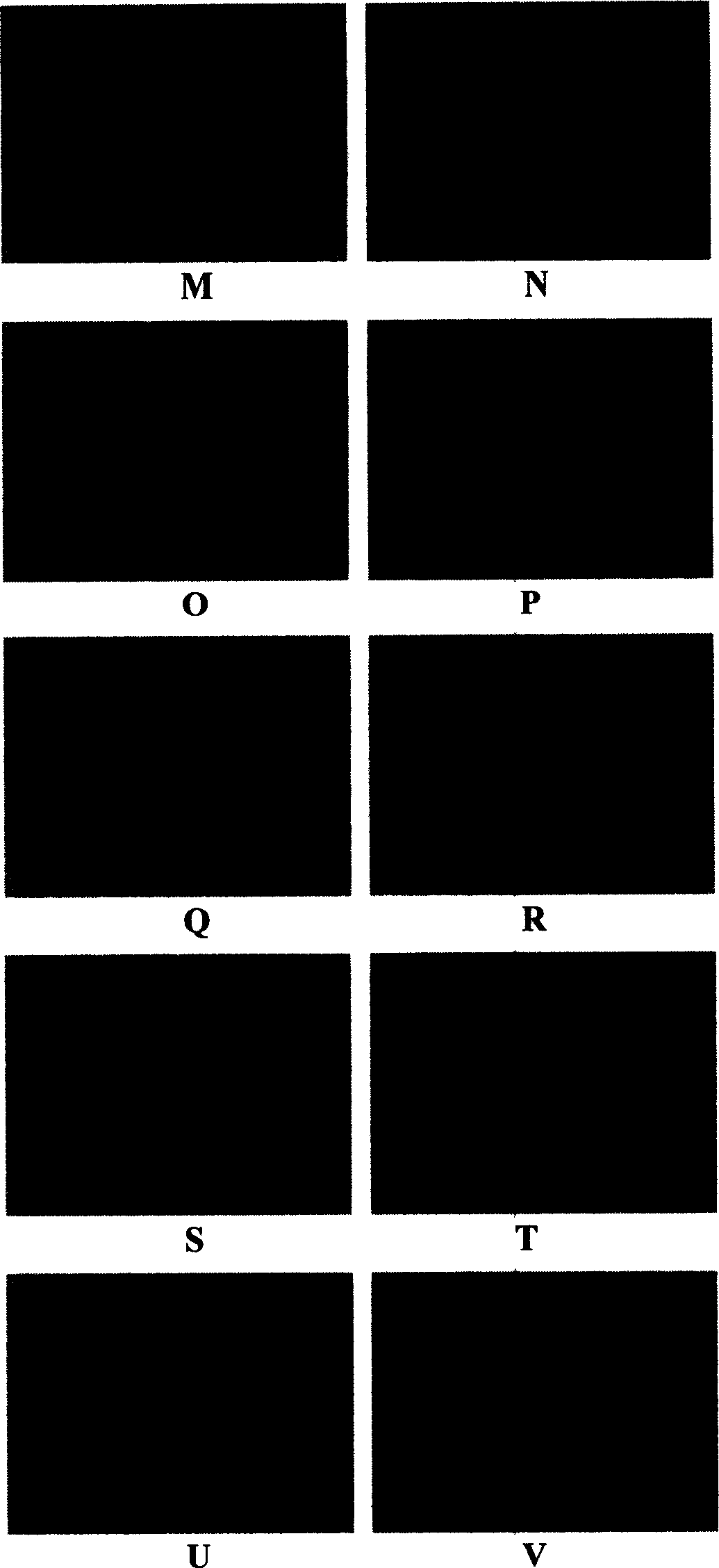 Attenuated vaccinia virus Tiantan strain vector and its preparation and application