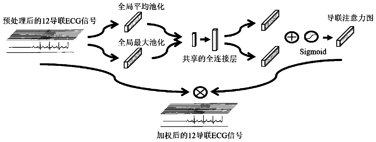 Multi-class arrhythmia detection method based on lead attention mechanism